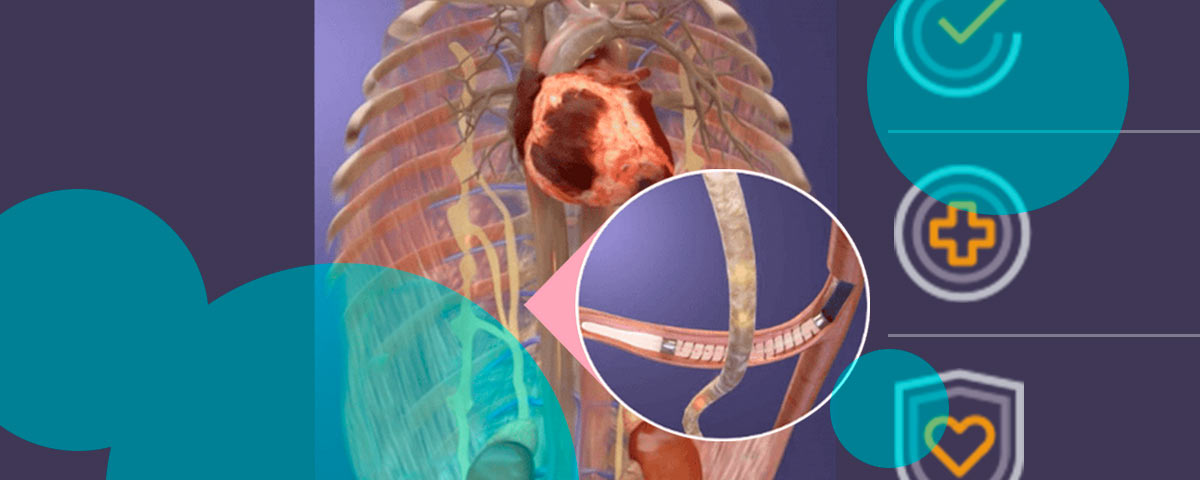 Axon Therapies raised $32 mn to push implant-free heart failure trials